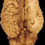 Comparisons of Different Brands of Modafinil for Sale: Which is Right for You?