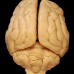 Buy Modafinil Online: Understanding the Risks and Precautions