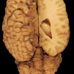 modafinil for sale: Enhancing Focus and Productivity in the Modern World
