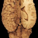 Modafinil: A Comprehensive Guide for Students and Professionals